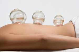 Cupping, Sleek Physique