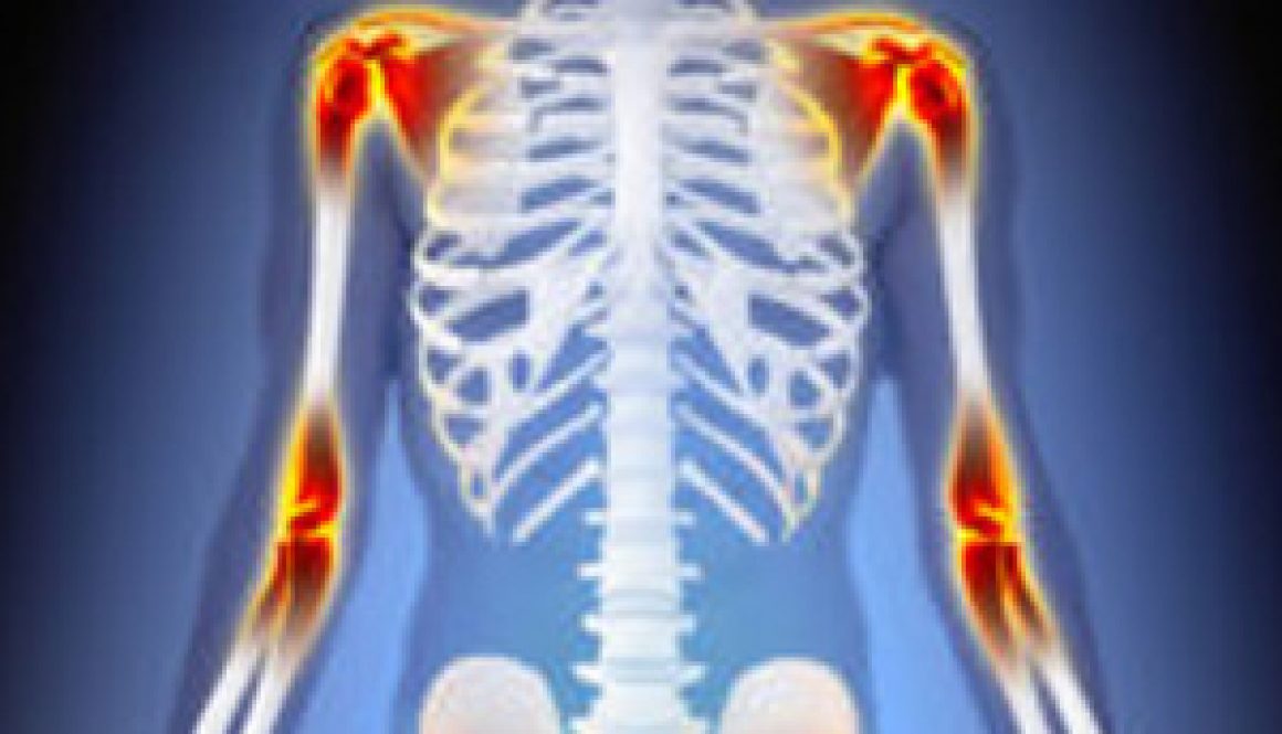 Arthritis-Joints-Pain-Anatomy-Male-concept-1-200x300