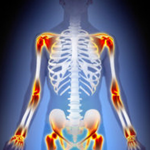 Arthritis-Joints-Pain-Anatomy-Male-concept-1-200x300